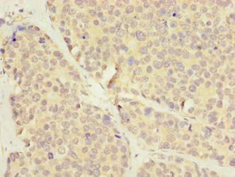LRRC8E Antibody