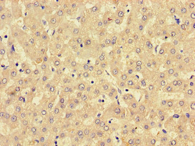LPCAT3 Antibody