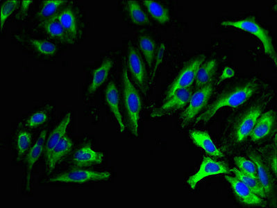TMEM270 Antibody