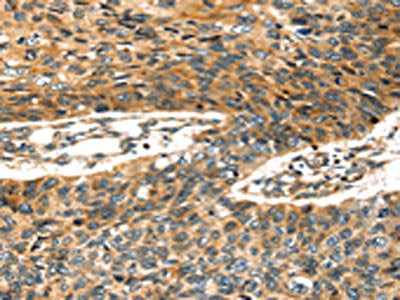 STX19 Antibody