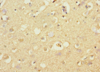 STRADA Antibody