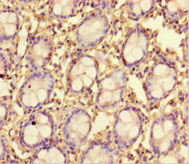 TMPRSS7 Antibody