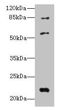 PYHIN1 Antibody