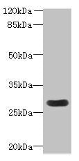 MORN3 Antibody