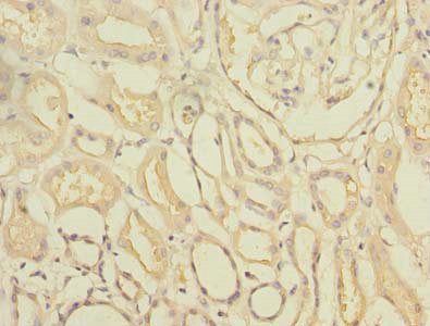 TTC33 Antibody