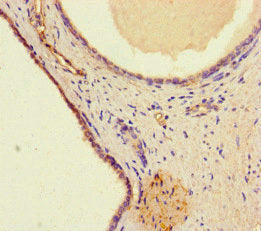 WDFY4 Antibody