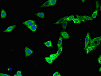 PLEKHA7 Antibody
