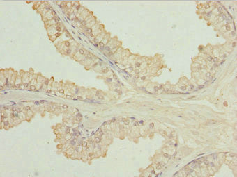 ULK3 Antibody