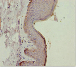 LRSAM1 Antibody