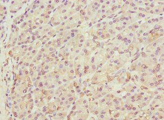 THADA Antibody
