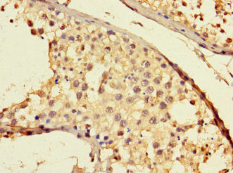 THADA Antibody