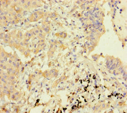 GBP6 Antibody