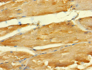 ABLIM2 Antibody