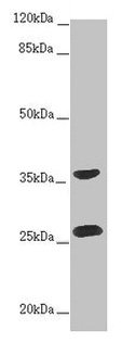 RAB12 Antibody