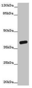 OGFOD2 Antibody