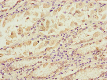 BLOC1S2 Antibody