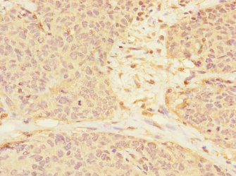 RASSF6 Antibody