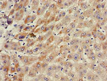 ACAD11 Antibody