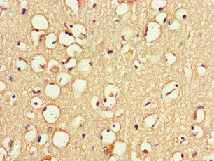 ZNF365 Antibody