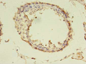 TUBA1A Antibody