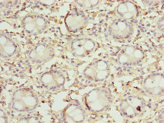 DENND5A Antibody