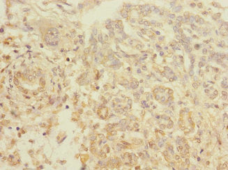 TIGD7 Antibody