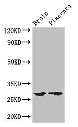FBXL22 Antibody