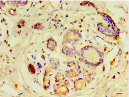 GTF2H2C Antibody