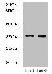 FOXR2 Antibody