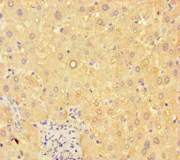 ANGPTL8 Antibody