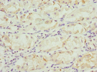 FGD5 Antibody