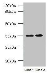 CFAP65 Antibody