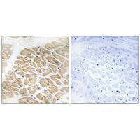 MIA Antibody