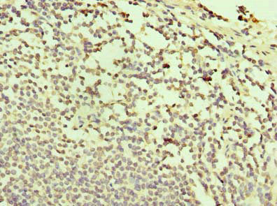 TXNDC11 Antibody