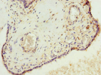 VHLL Antibody