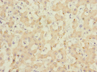 ADAMTSL4 Antibody