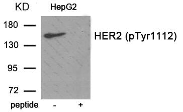 Phospho-ERBB2 (Tyr1112) Antibody