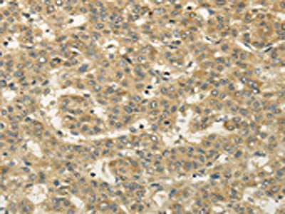 SEMA4F Antibody