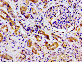 MARK2 Antibody