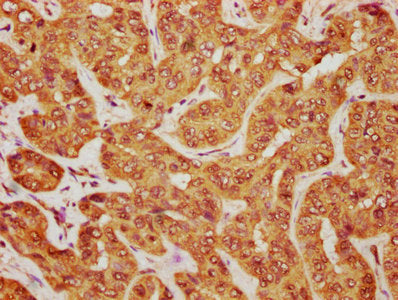 MOB1B Antibody