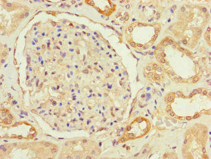 PRMT9 Antibody