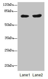 PGM2L1 Antibody