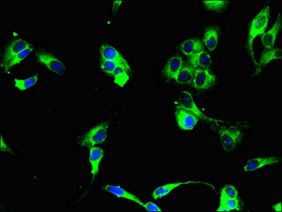 LINC00299 Antibody