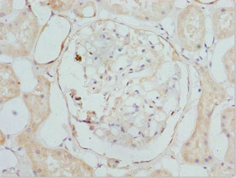 CYP4V2 Antibody