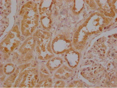 USP30 Antibody