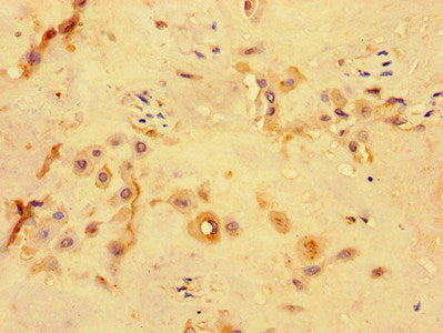 PKD1L3 Antibody