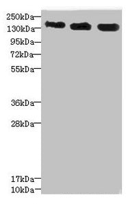 ANKS1B Antibody