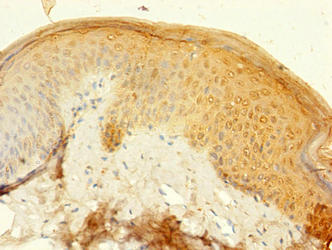 KRT77 Antibody