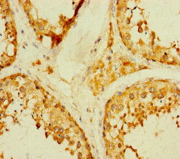 TADA2B Antibody