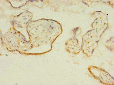 ITIH5 Antibody